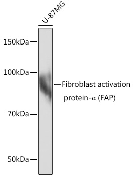 Fibroblast activation protein-_ (FAP) Rabbit mAb