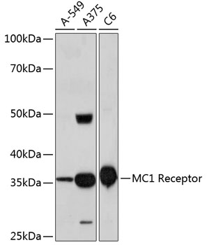 MC1 Receptor Rabbit mAb