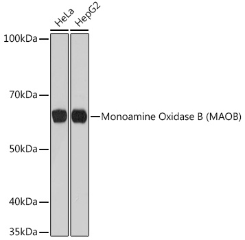 Monoamine Oxidase B (MAOB) Rabbit mAb