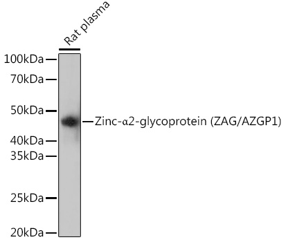 Zinc-_2-glycoprotein (ZAG/AZGP1) Rabbit mAb
