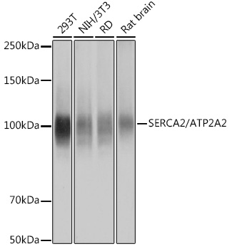 SERCA2/ATP2A2 Rabbit mAb