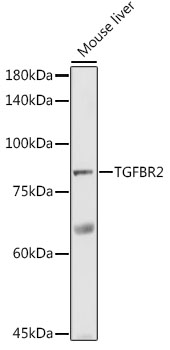 TGF beta Receptor II (TGFBR2) Rabbit pAb