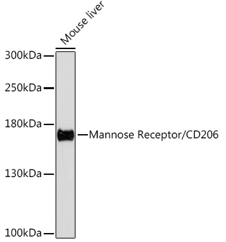 Mannose Receptor/CD206 Rabbit pAb