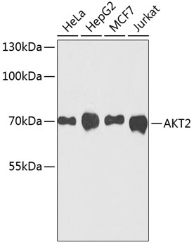 AKT2 Mouse mAb