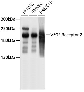 VEGF Receptor 2 Rabbit mAb