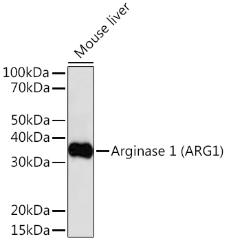 Arginase 1 (ARG1) Rabbit pAb