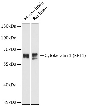 Cytokeratin 1 (KRT1) Rabbit pAb