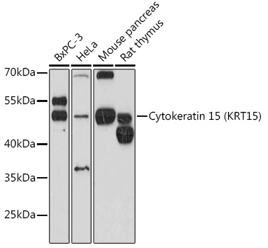 Cytokeratin 15 (KRT15) Rabbit pAb