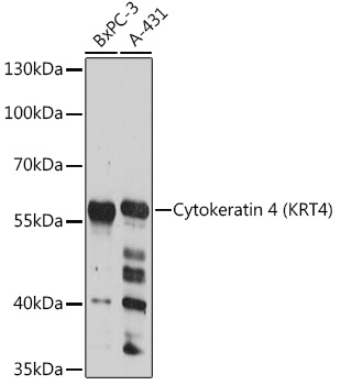 Cytokeratin 4 (KRT4) Rabbit pAb