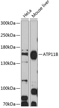 ATP11B Rabbit pAb