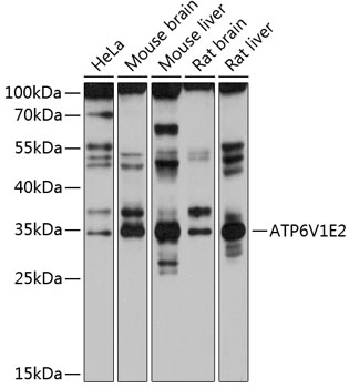 ATP6V1E2 Rabbit pAb