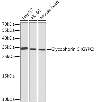 Glycophorin C (GYPC) Rabbit pAb