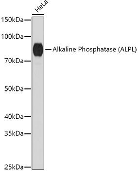 Alkaline Phosphatase (ALPL) Rabbit pAb