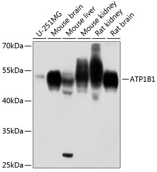 ATP1B1 Rabbit pAb