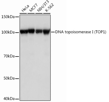 DNA topoisomerase I (TOP1) Rabbit mAb