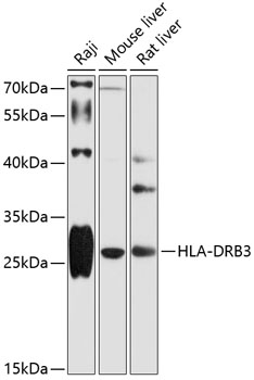 HLA-DRB3 Rabbit pAb