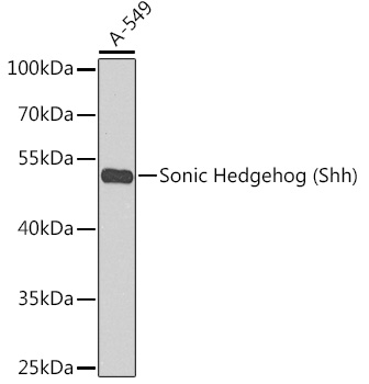 Sonic Hedgehog (Shh) Rabbit pAb