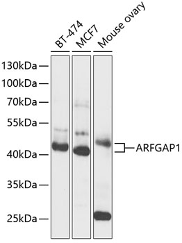 ARFGAP1 Rabbit pAb