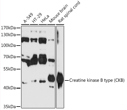 Creatine kinase B type (CKB) Rabbit pAb