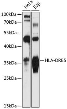 HLA-DRB5 Rabbit pAb