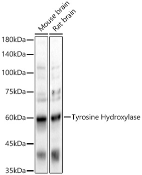 Tyrosine Hydroxylase Rabbit pAb