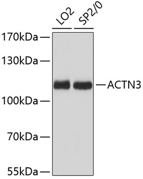 ACTN3 Rabbit pAb