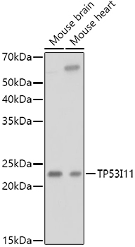 TP53I11 Rabbit pAb