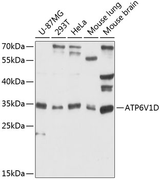 ATP6V1D Rabbit pAb