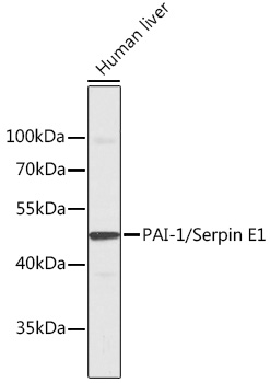 PAI-1/Serpin E1 Rabbit pAb
