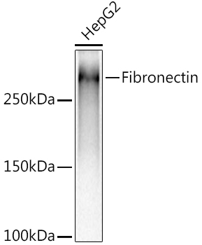 Fibronectin Rabbit mAb