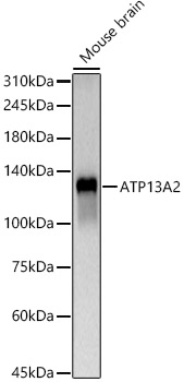 ATP13A2 Rabbit pAb