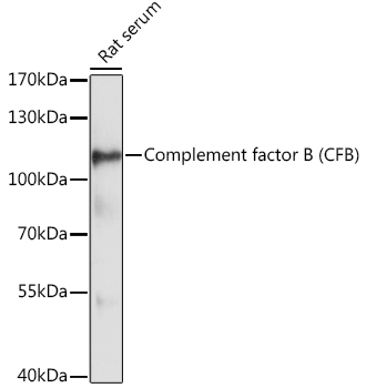 Complement factor B (CFB) Rabbit pAb