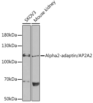 Alpha2-adaptin/AP2A2 Rabbit pAb