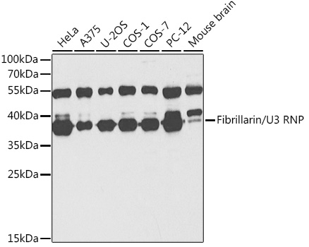 Fibrillarin/U3 RNP Rabbit pAb