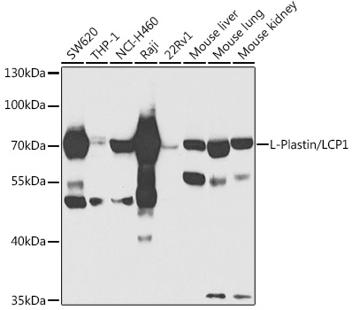 L-Plastin/LCP1 Rabbit pAb