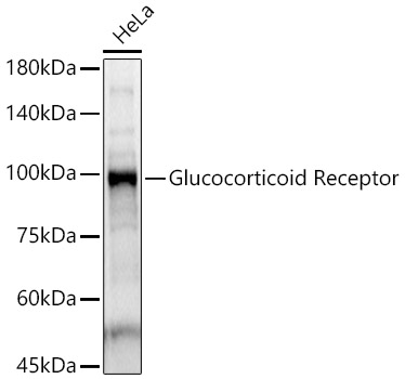 Glucocorticoid Receptor Rabbit pAb