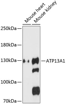 ATP13A1 Rabbit pAb