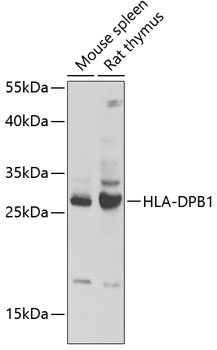 HLA-DPB1 Rabbit pAb