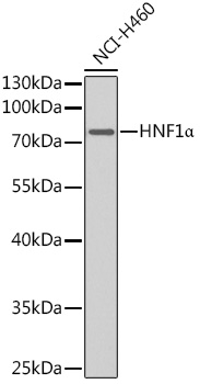 HNF1_ Mouse mAb