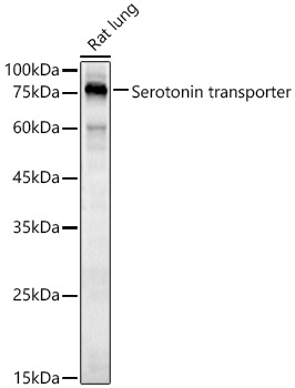 Serotonin transporter Rabbit pAb
