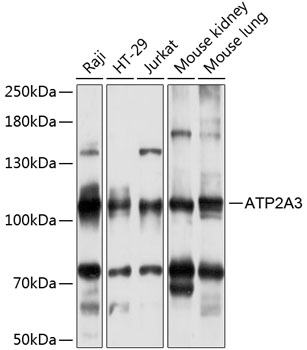 ATP2A3 Rabbit pAb