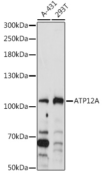 ATP12A Rabbit pAb