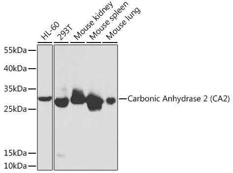 Carbonic Anhydrase 2 (CA2) Rabbit pAb