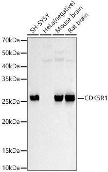 CDK5R1 Rabbit pAb