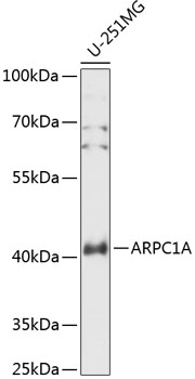 ARPC1A Rabbit pAb