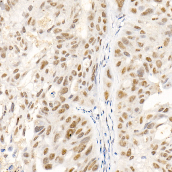  SOCS1 Rabbit mAb 