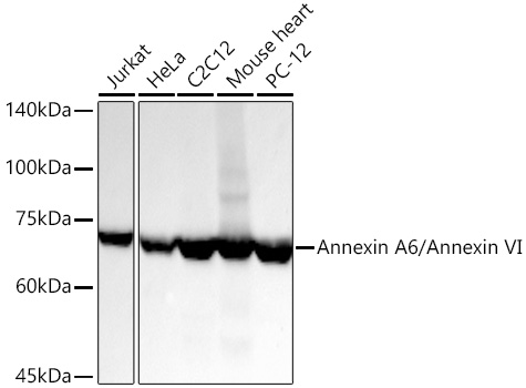  Annexin A6/Annexin VI Rabbit mAb 