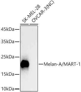  Melan-A/MART-1 Rabbit mAb 