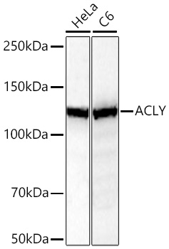  ACLY Rabbit mAb 