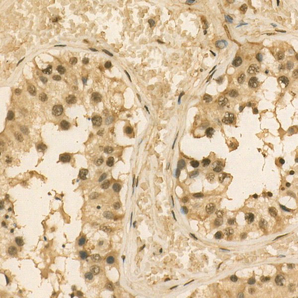  PSMC4 Rabbit mAb 